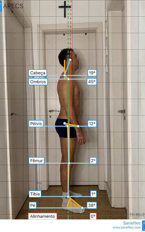 Análise postural frontal na Fisio Performa