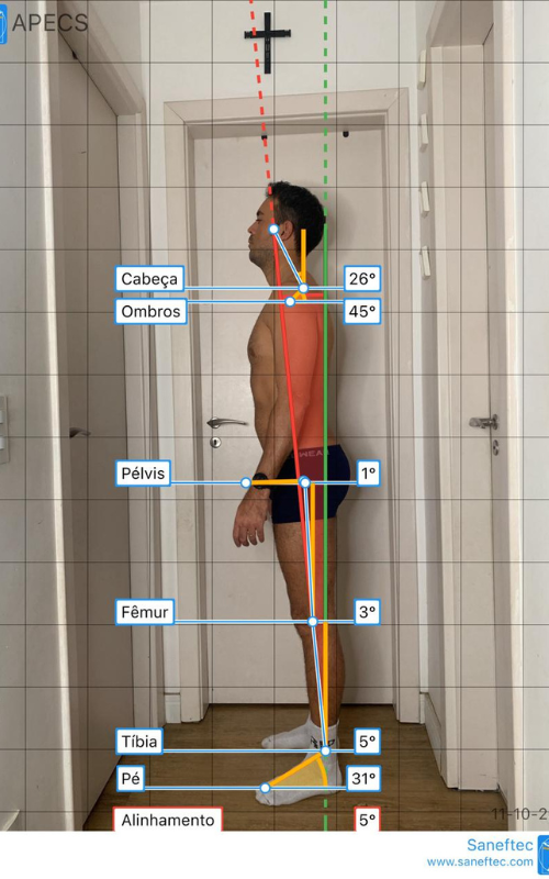 Análise postural traseira na Fisio Performa