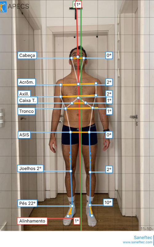 Análise postural detalhada na Fisio Performa